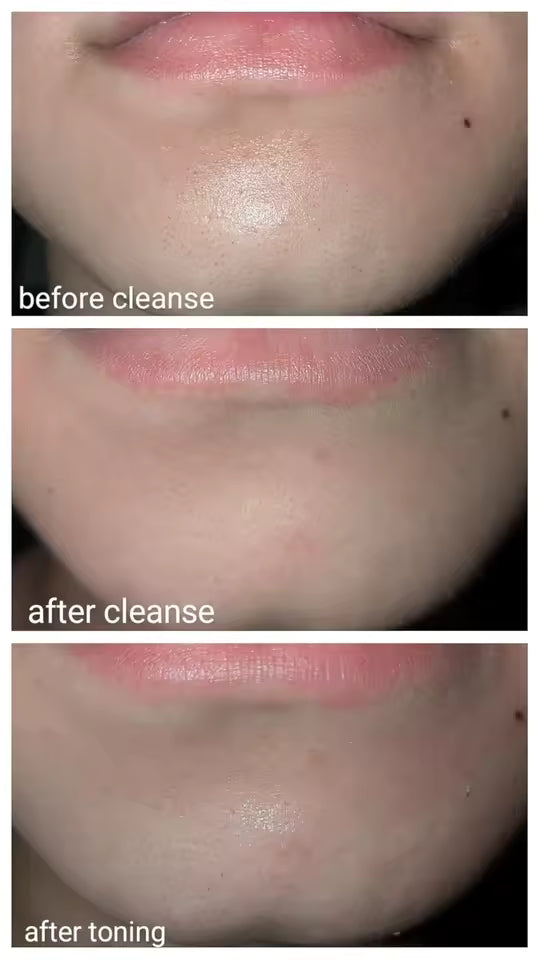 Signature Glow Skincare Set